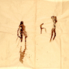 Drawings with autologous blood